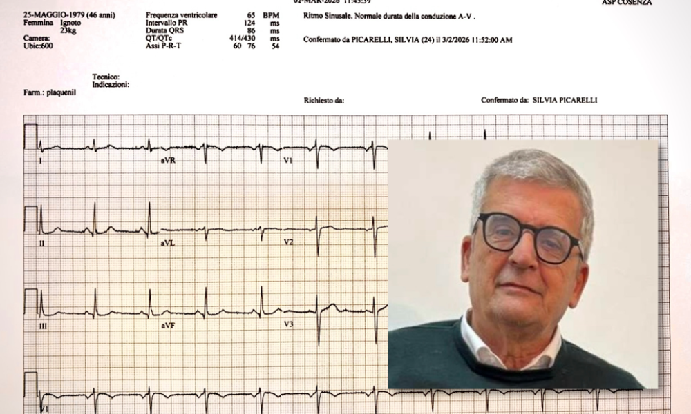 elettrocardiogramma da remoto